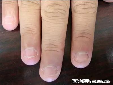 剪指甲、挖耳屎，这些日常小动作竟隐藏大危害！ - 巴彦淖尔盟生活资讯 - 巴彦淖尔盟28生活网 bycem.28life.com